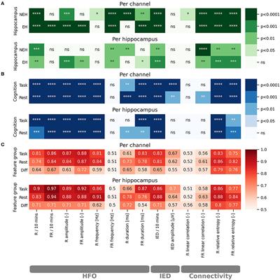 Cognitive Processing Impacts High Frequency Intracranial EEG Activity of Human Hippocampus in Patients With Pharmacoresistant Focal Epilepsy